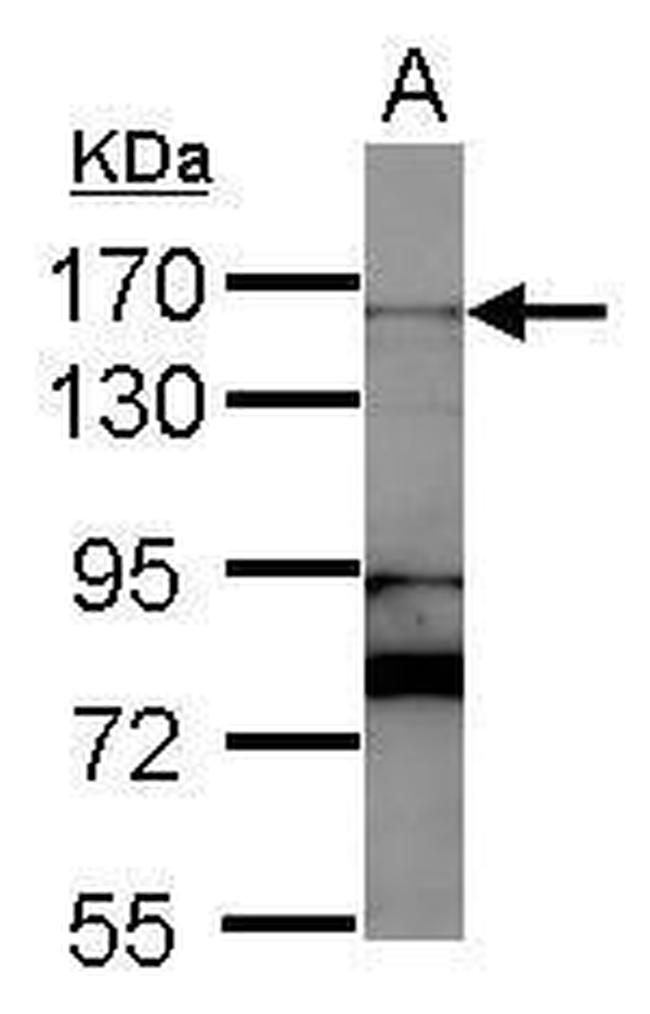 RAD50 Antibody in Western Blot (WB)