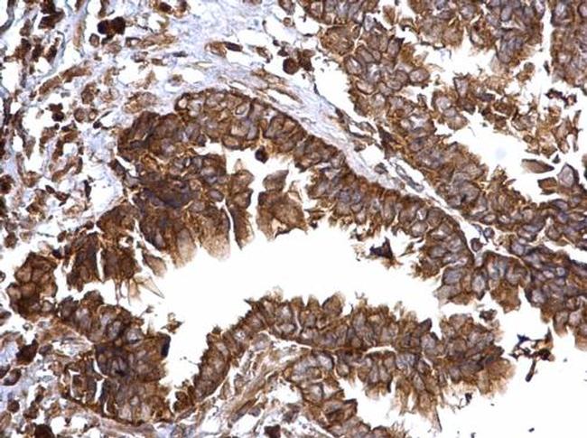 Bcl-xS Antibody in Immunohistochemistry (Paraffin) (IHC (P))