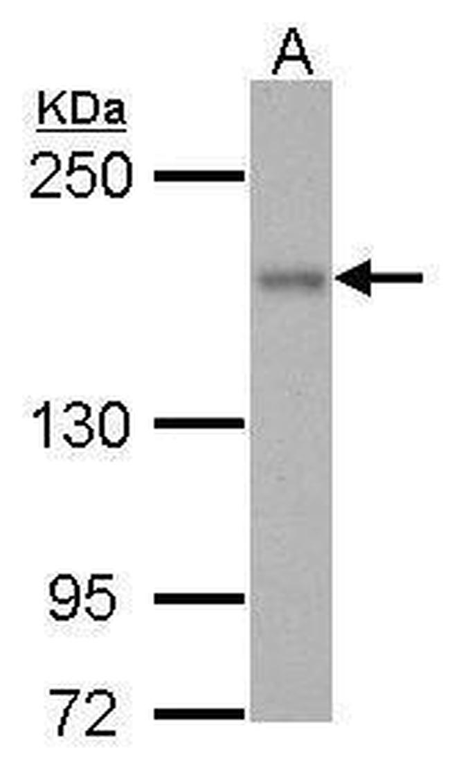 ROCK1 Antibody in Western Blot (WB)