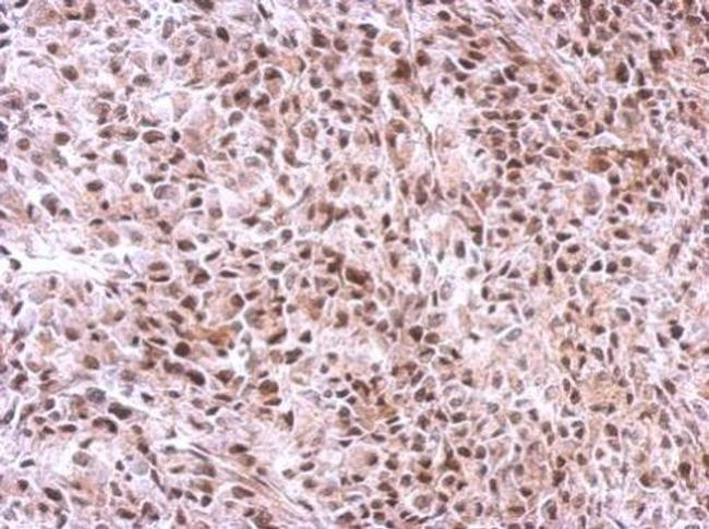 SLU7 Antibody in Immunohistochemistry (Paraffin) (IHC (P))