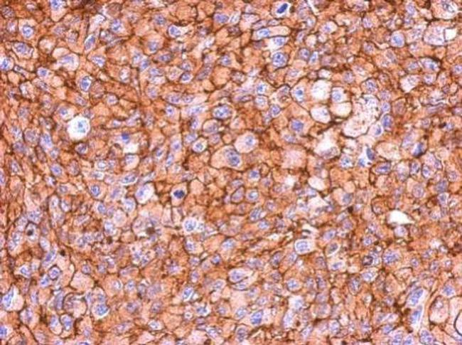 MYO1C Antibody in Immunohistochemistry (Paraffin) (IHC (P))