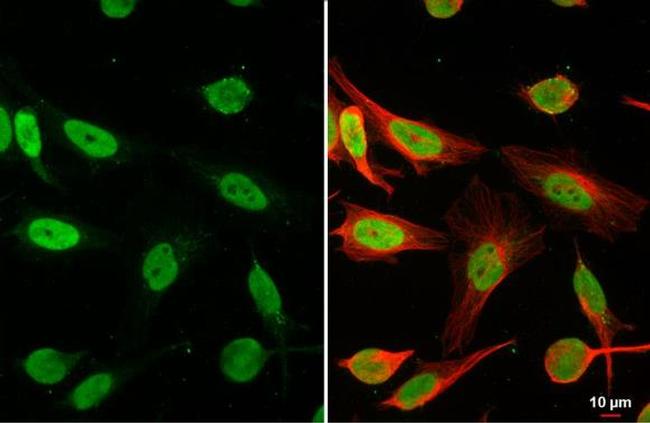 HMGB1 Antibody in Immunocytochemistry (ICC/IF)