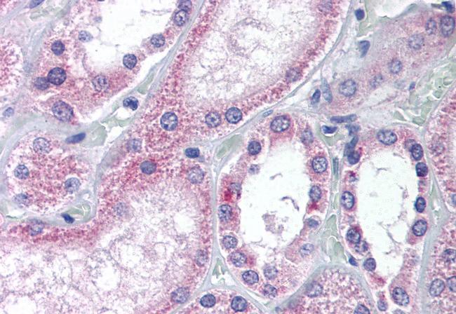 AADAT Antibody in Immunohistochemistry (Paraffin) (IHC (P))