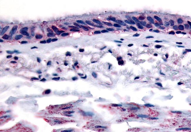 AHR Antibody in Immunohistochemistry (Paraffin) (IHC (P))