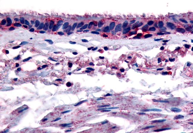 AHR Antibody in Immunohistochemistry (Paraffin) (IHC (P))