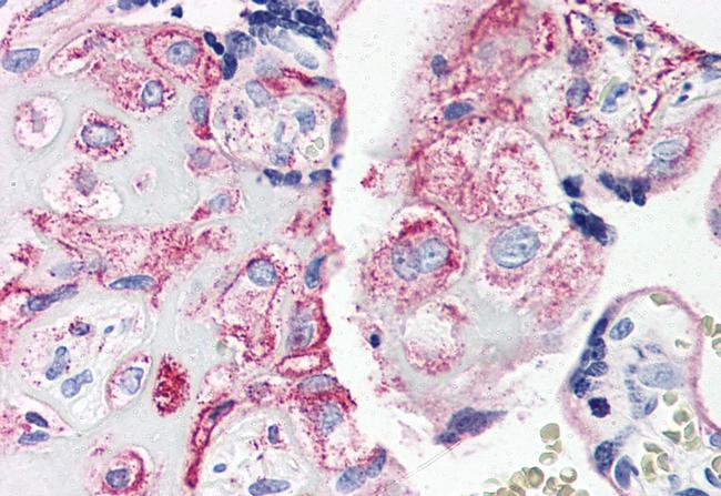 C5AR1 Antibody in Immunohistochemistry (Paraffin) (IHC (P))