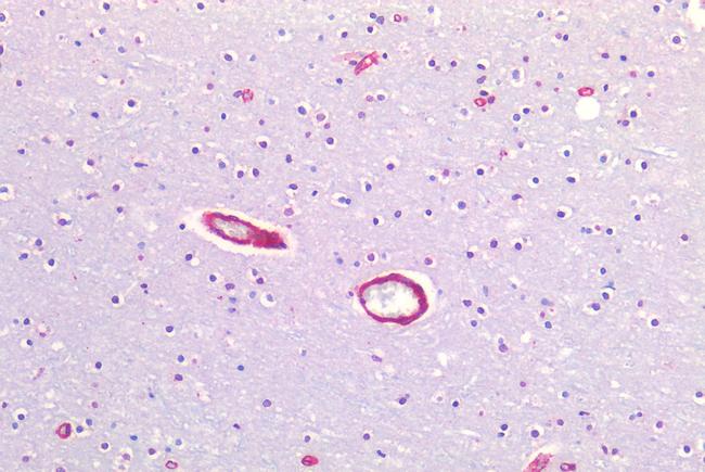 Caveolin 1 Antibody in Immunohistochemistry (Paraffin) (IHC (P))