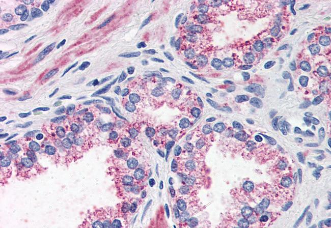 CCKAR Antibody in Immunohistochemistry (Paraffin) (IHC (P))