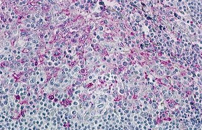 CCR8 Antibody in Immunohistochemistry (Paraffin) (IHC (P))