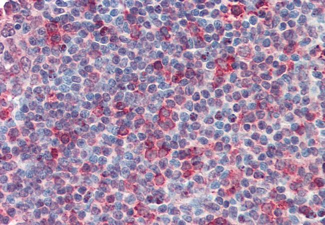 CD70 Antibody in Immunohistochemistry (Paraffin) (IHC (P))