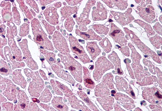 CYSLTR2 Antibody in Immunohistochemistry (Paraffin) (IHC (P))