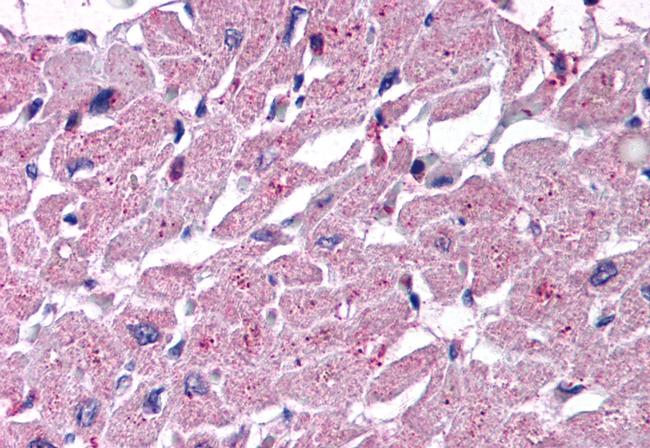 CYSLTR2 Antibody in Immunohistochemistry (Paraffin) (IHC (P))