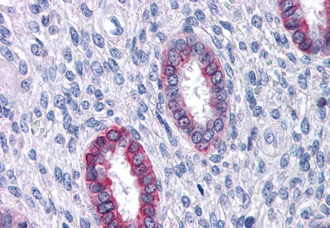 DPEP1 Antibody in Immunohistochemistry (Paraffin) (IHC (P))