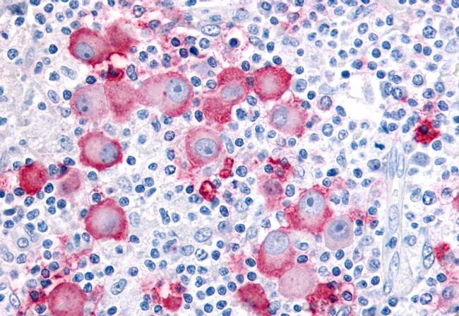 EPHX2 Antibody in Immunohistochemistry (Paraffin) (IHC (P))