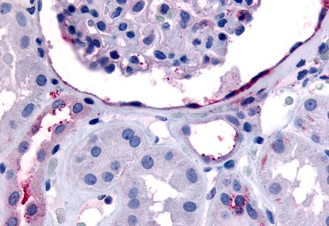 ErbB4 Antibody in Immunohistochemistry (Paraffin) (IHC (P))