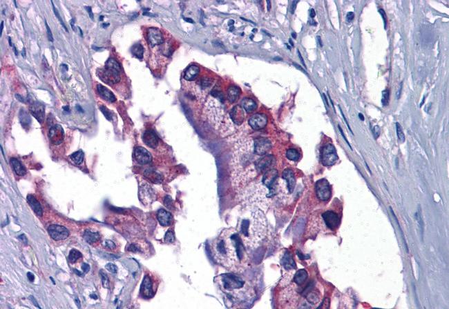 GFPT1 Antibody in Immunohistochemistry (Paraffin) (IHC (P))