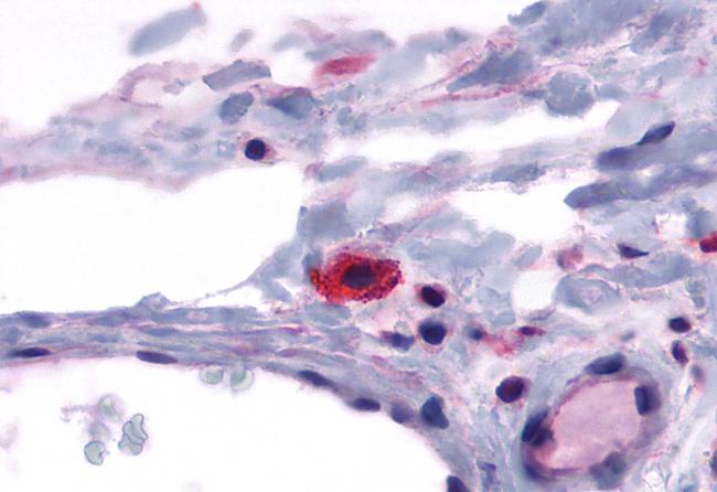 CRTH2 Antibody in Immunohistochemistry (Paraffin) (IHC (P))