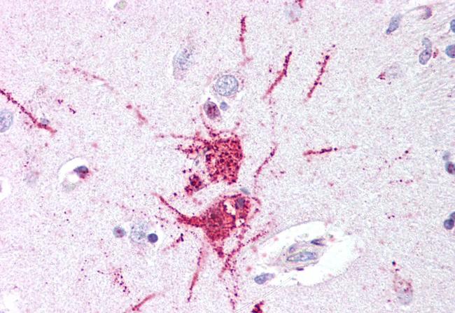 GPR52 Antibody in Immunohistochemistry (Paraffin) (IHC (P))