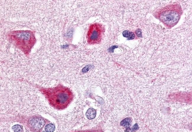 GPR77 Antibody in Immunohistochemistry (Paraffin) (IHC (P))