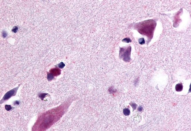 GPR77 Antibody in Immunohistochemistry (Paraffin) (IHC (P))