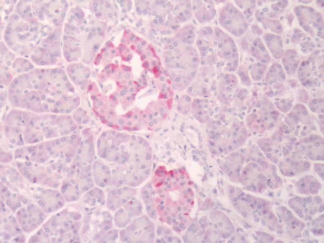 INSR Antibody in Immunohistochemistry (Paraffin) (IHC (P))