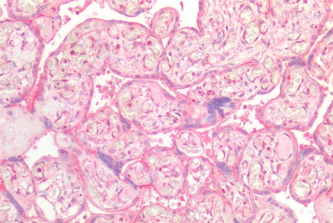 INSR Antibody in Immunohistochemistry (Paraffin) (IHC (P))