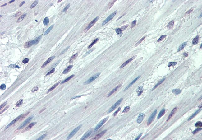 ITGA3 Antibody in Immunohistochemistry (Paraffin) (IHC (P))