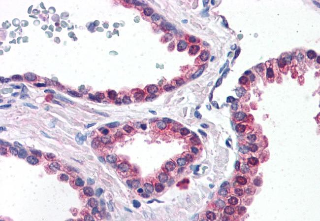 LOXL2 Antibody in Immunohistochemistry (Paraffin) (IHC (P))