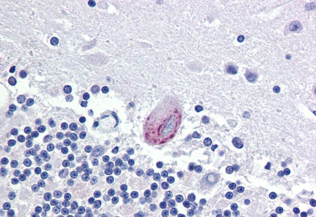 LPCAT1 Antibody in Immunohistochemistry (Paraffin) (IHC (P))