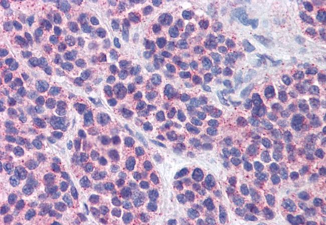 MBOAT4 Antibody in Immunohistochemistry (Paraffin) (IHC (P))