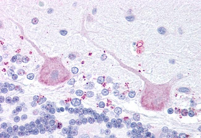 MCHR2 Antibody in Immunohistochemistry (Paraffin) (IHC (P))