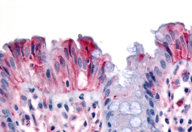 RON Antibody in Immunohistochemistry (Paraffin) (IHC (P))