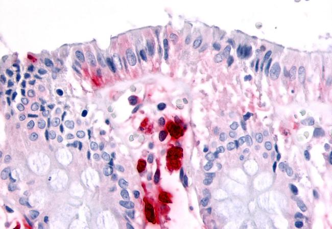 RON Antibody in Immunohistochemistry (Paraffin) (IHC (P))