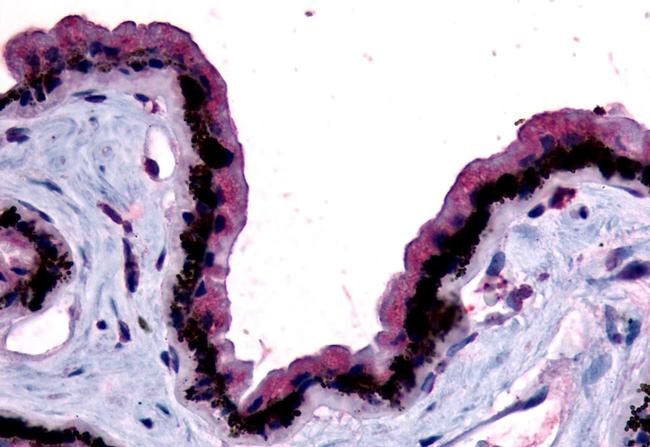 MTNR1B Antibody in Immunohistochemistry (Paraffin) (IHC (P))