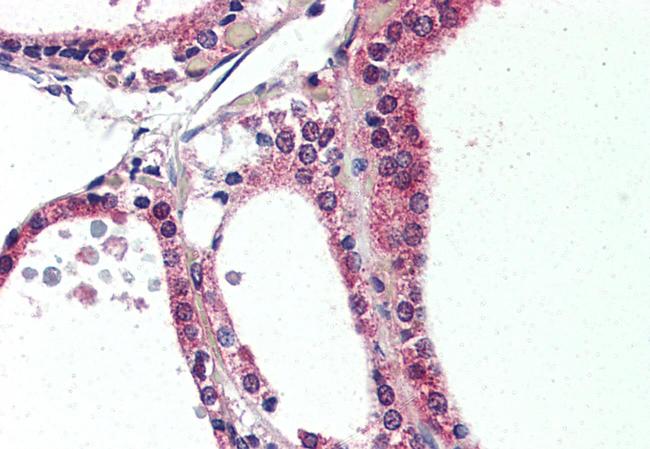 NR1D2 Antibody in Immunohistochemistry (Paraffin) (IHC (P))