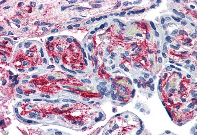 PCSK6 Antibody in Immunohistochemistry (Paraffin) (IHC (P))