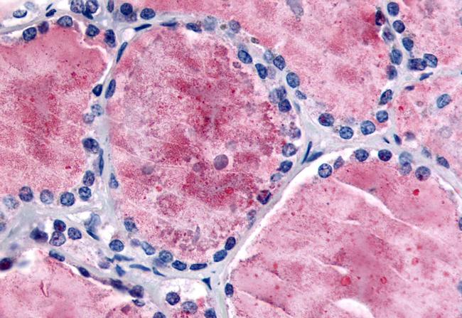 PDE8B Antibody in Immunohistochemistry (Paraffin) (IHC (P))