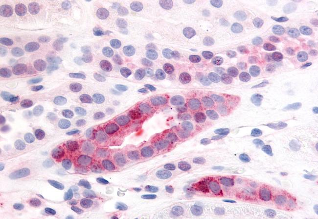 PDGFRB Antibody in Immunohistochemistry (Paraffin) (IHC (P))