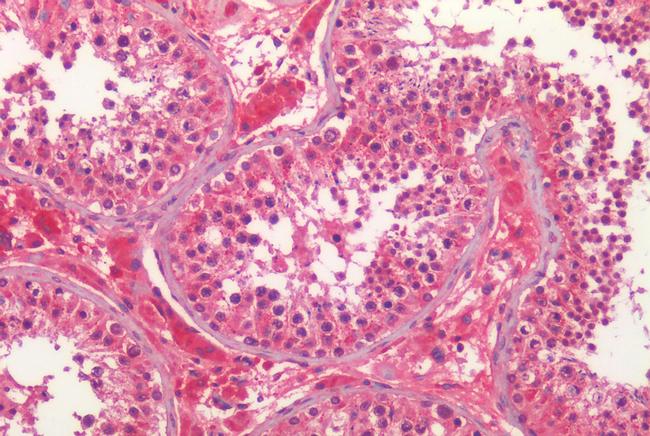 PTGES Antibody in Immunohistochemistry (Paraffin) (IHC (P))