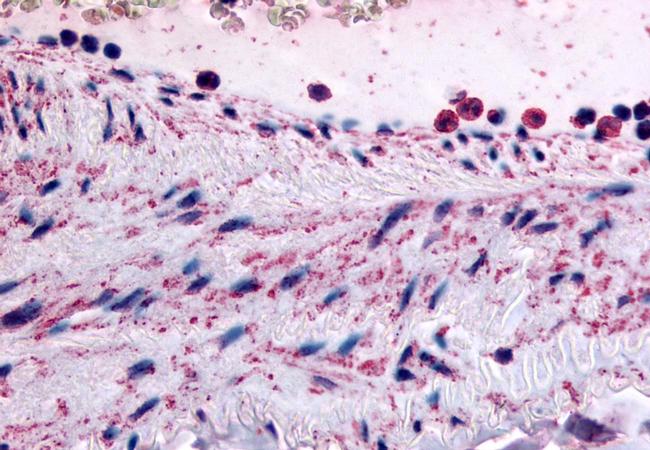 PTPMT1 Antibody in Immunohistochemistry (Paraffin) (IHC (P))