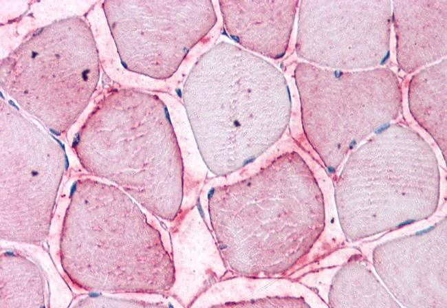 SEMA4B Antibody in Immunohistochemistry (Paraffin) (IHC (P))