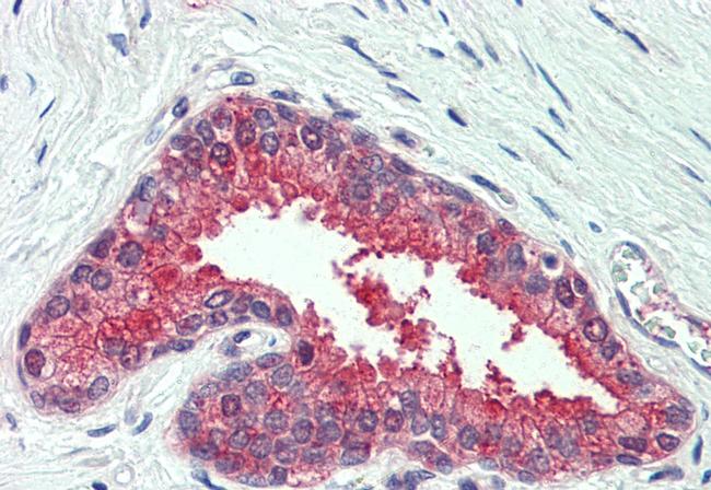 NKCC1 Antibody in Immunohistochemistry (Paraffin) (IHC (P))