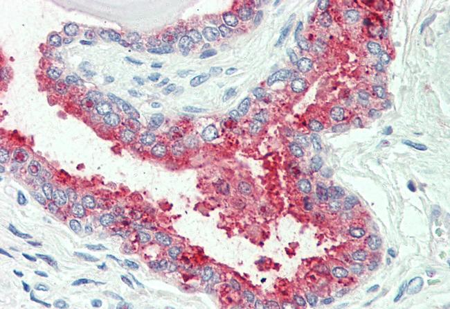 NKCC1 Antibody in Immunohistochemistry (Paraffin) (IHC (P))