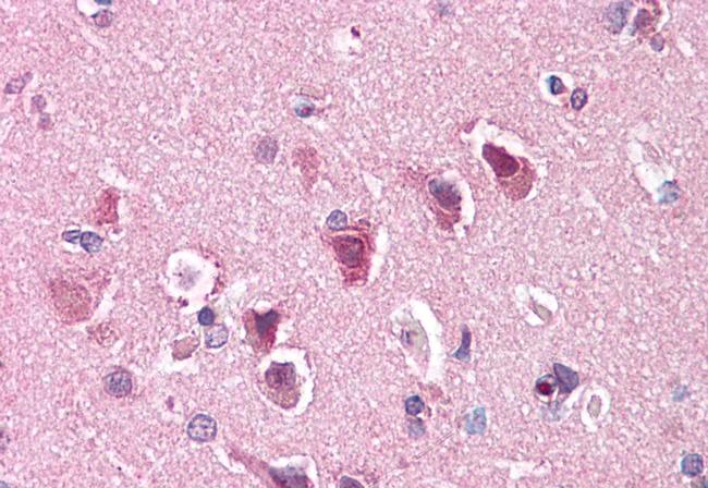 ENT1 Antibody in Immunohistochemistry (Paraffin) (IHC (P))