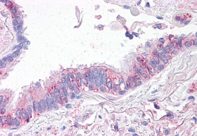 CTR1 Antibody in Immunohistochemistry (Paraffin) (IHC (P))