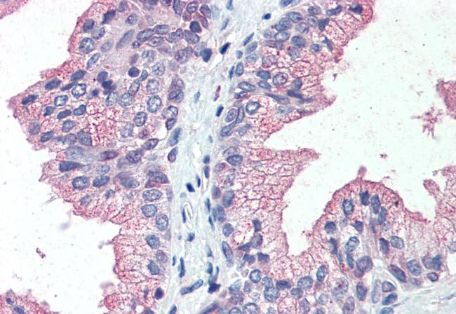 ZIP14 Antibody in Immunohistochemistry (Paraffin) (IHC (P))