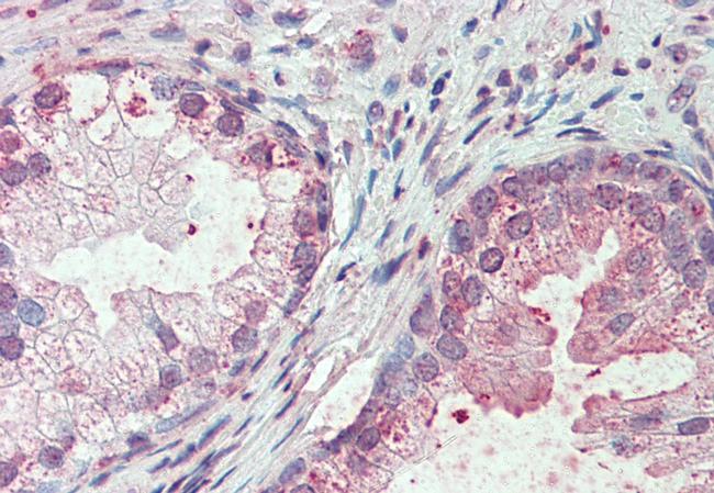 SLC44A2 Antibody in Immunohistochemistry (Paraffin) (IHC (P))