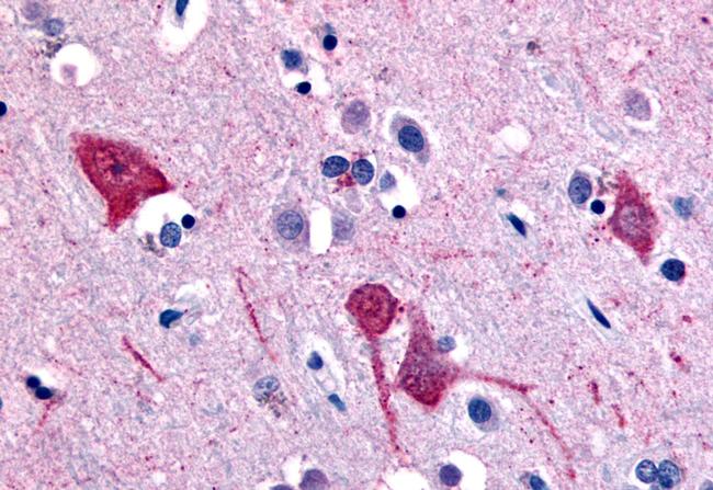 SLC5A11 Antibody in Immunohistochemistry (Paraffin) (IHC (P))