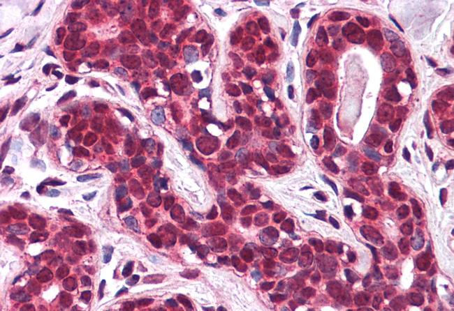 SLC5A6 Antibody in Immunohistochemistry (Paraffin) (IHC (P))