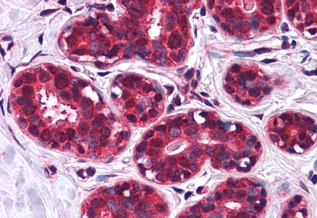 SLC5A6 Antibody in Immunohistochemistry (Paraffin) (IHC (P))